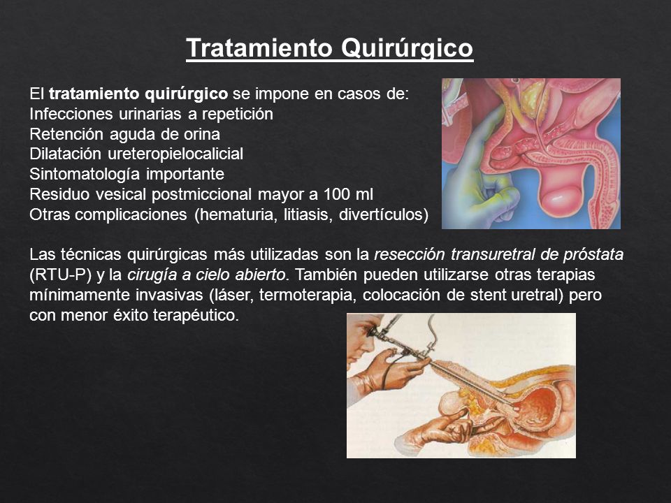 adenoma de próstata rtu